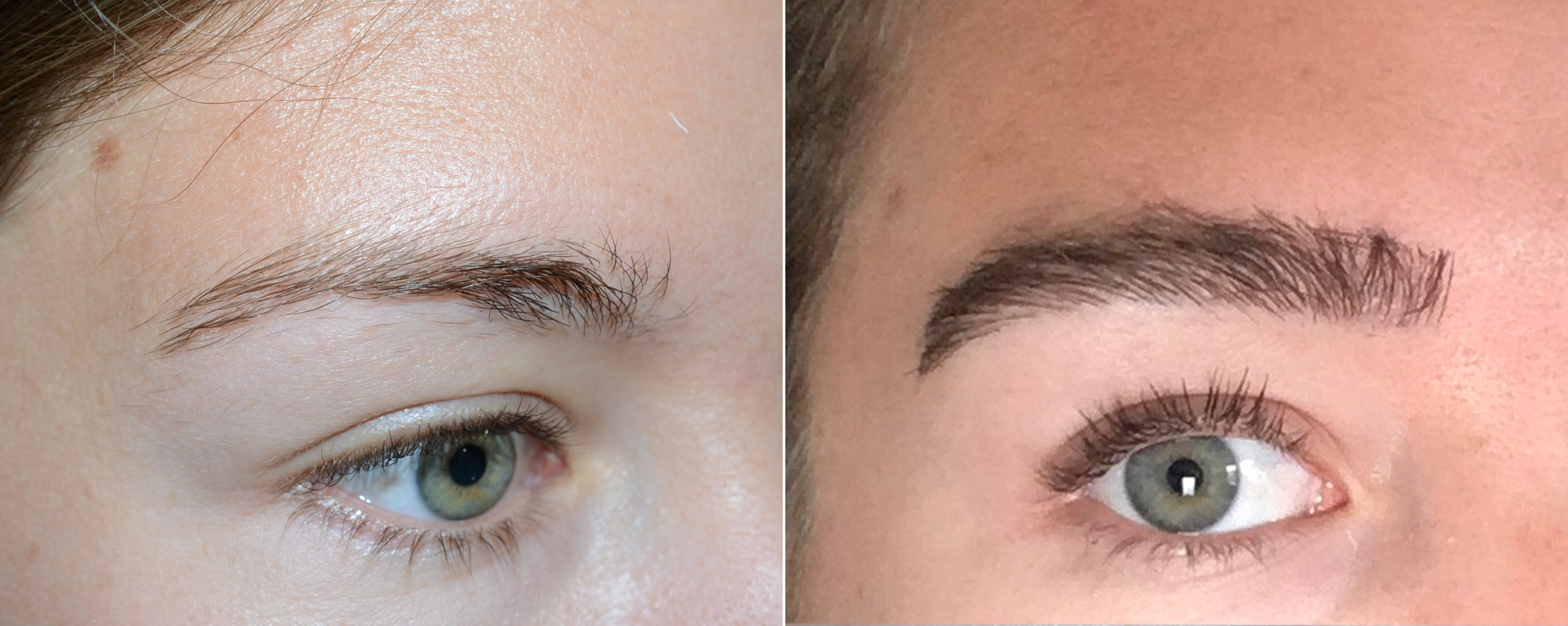 TED eyebrow in woman