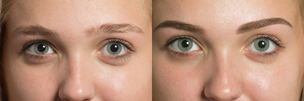 TED eyebrow in woman
