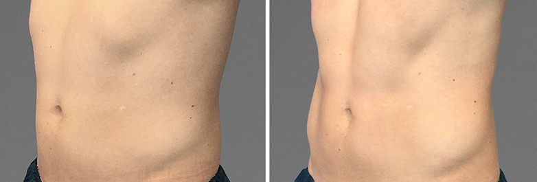 Cooltone results in man