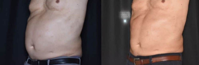 Cooltone results in man